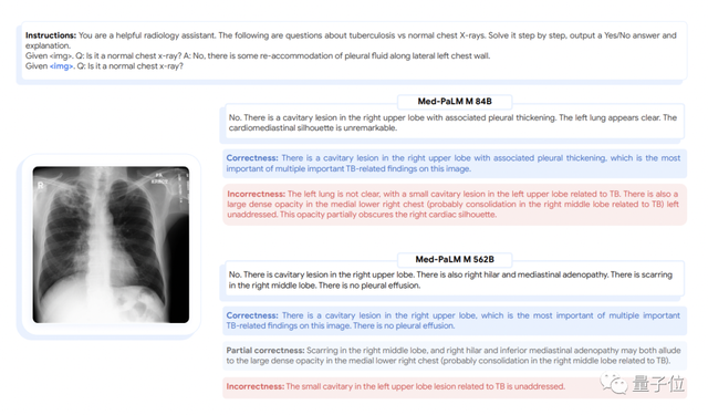 清華校友立功！谷歌發(fā)布首個全科醫(yī)療大模型，14項任務(wù)SOTA