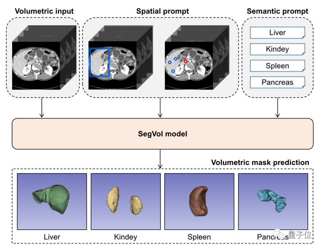 醫學通用分割模型來了！一口氣分割200多個解剖類別，發布即開源 | 智源出品