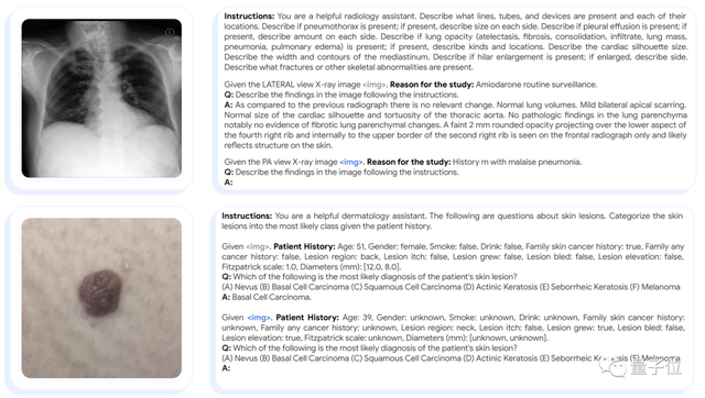 清華校友立功！谷歌發(fā)布首個全科醫(yī)療大模型，14項任務(wù)SOTA