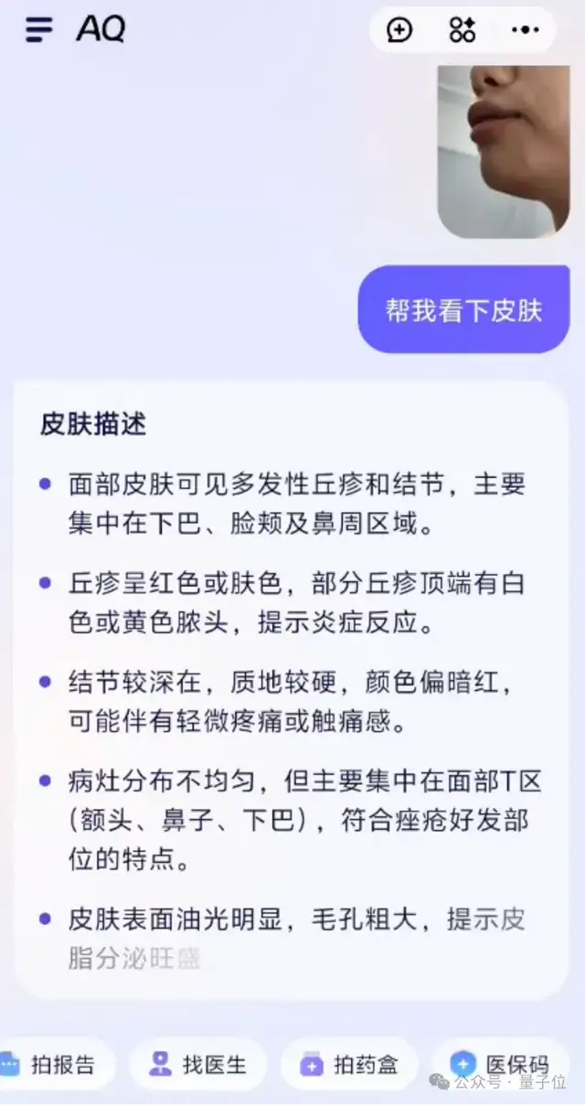 全民AI健康管家來了！實測螞蟻AQ：追問識藥看皮膚，連醫院接硬件